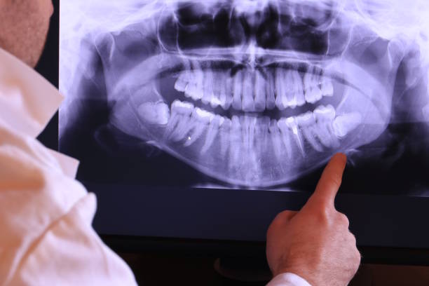 Best Walk-In Emergency Dental Services in Ferndale, CA